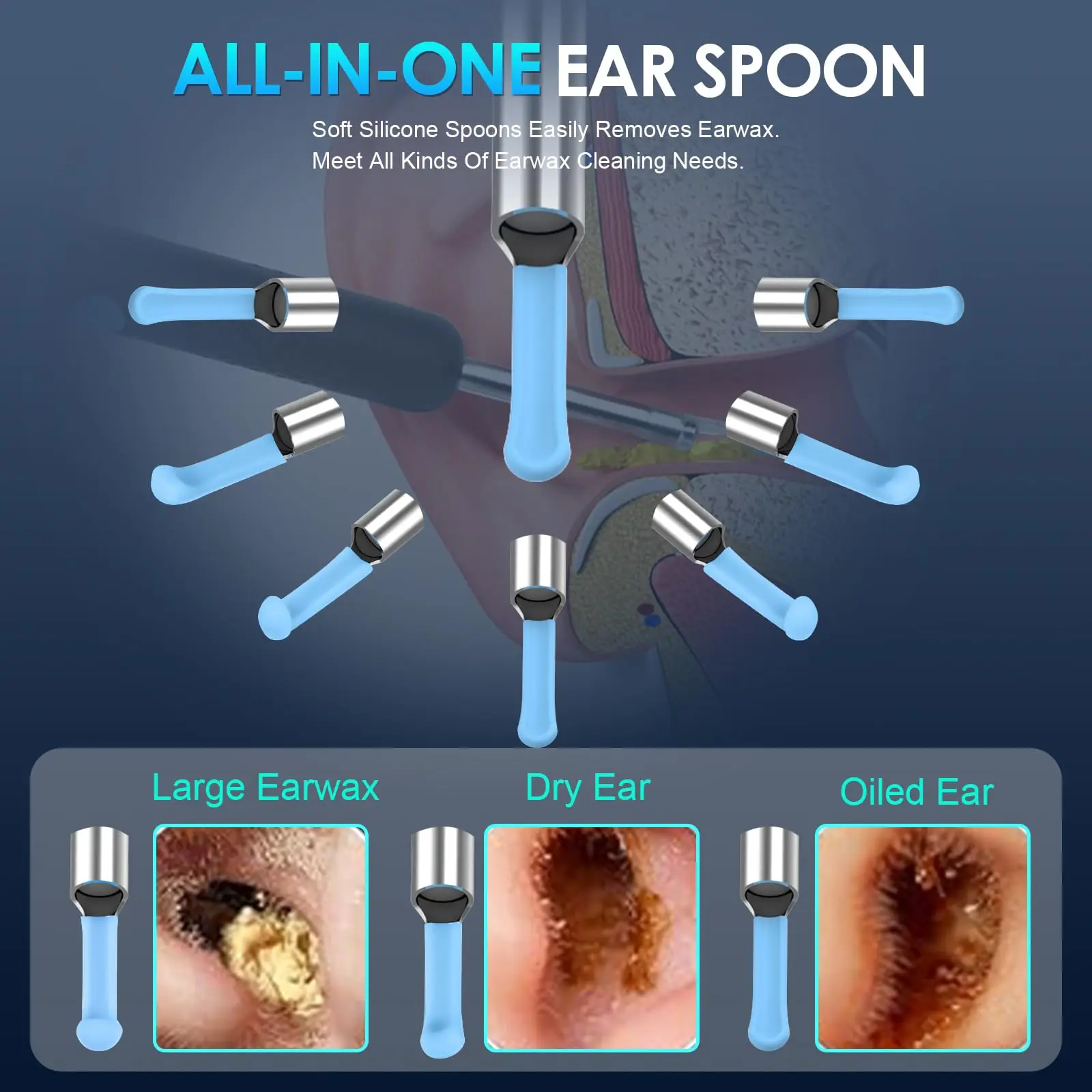 Ear Wax Removal, Upgraded Ear Cleaner with 1920P Camera, Ear Wax Removal Tool Camera with 8 Pcs Ear Set, with 7 Ear Spoon