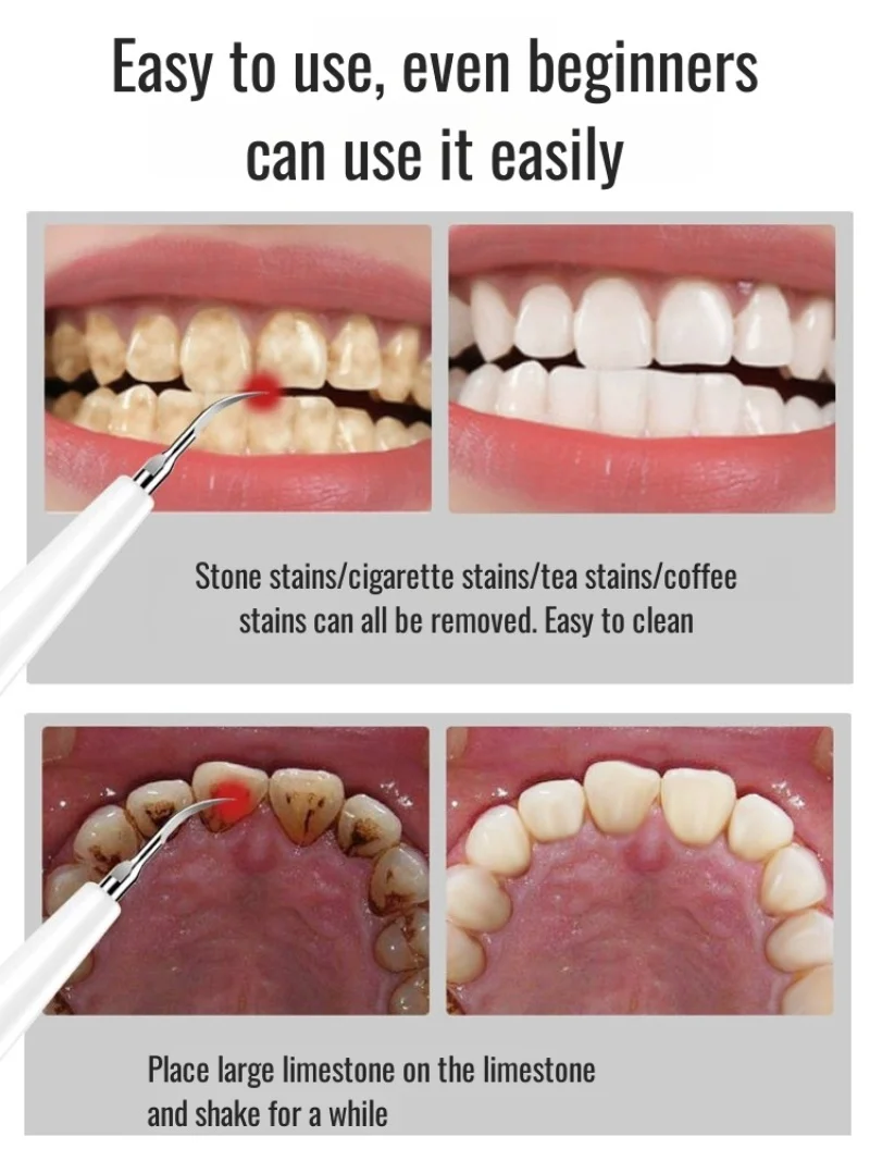 Dom przenośny środek do czyszczenia zębów środek do usuwania kamienia nazębnego ultradźwiękowy środek do czyszczenia zębów skaler środek do czyszczenia zębów Yanxiang