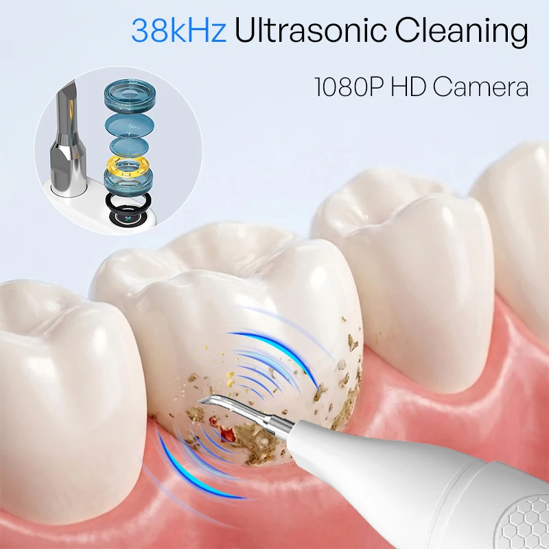 Thumbnail 4 - #32 Ultrasonic Scalers List of Top Picks