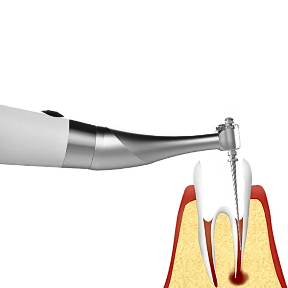 AG Endodontic Motor Machine with Apex Locator Files Selection Wireless Brushless 6:1 E Connect Expansion Motor for Dental Clinic