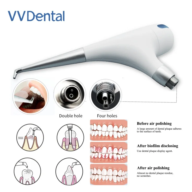 

VVDental PV-3 стоматологический Пескоструйный пистолет, противовсасывающая гигиеническая ручная полировальная машина, инструменты для полировки зубов