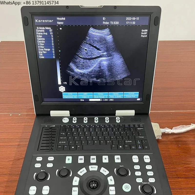 

Portable Animal Care Instrument Machine for Cattle Cow Horse Goat - Essential Equipment for Animal Management