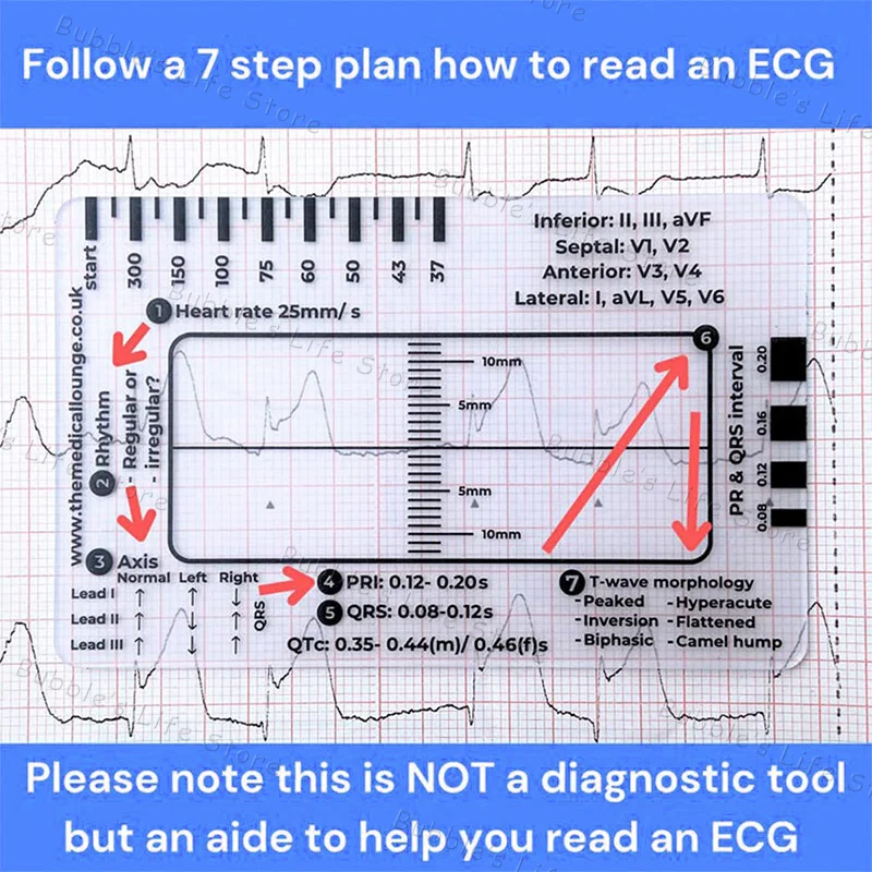 Ecg 7 Step Ruler Po…