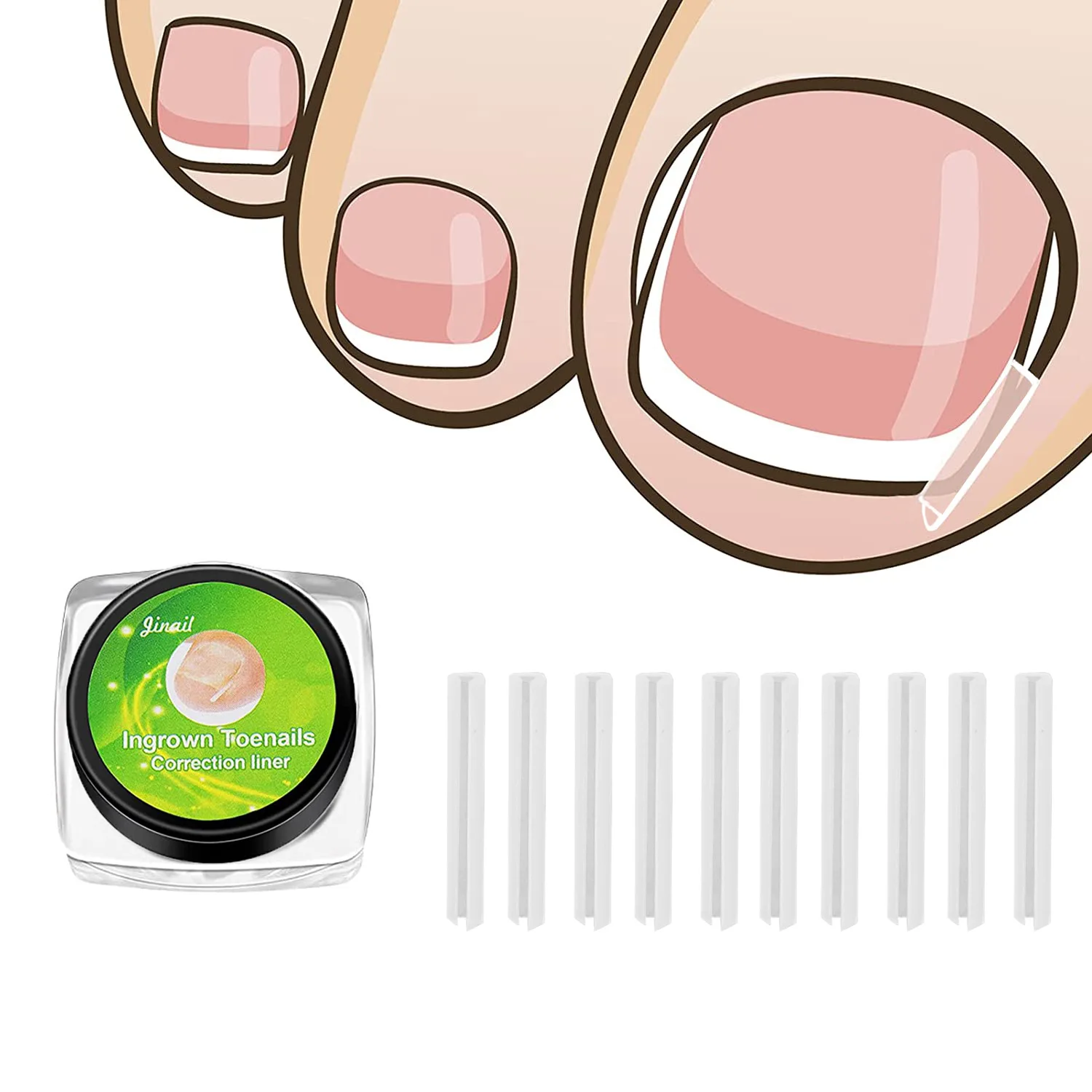 10-60pcs Ingrown Toenail Correction Tool Ingrown Toe Nail Treatment Elastic Patch Sticker Straightening Clip Brace Pedicure Tool