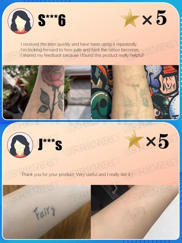 A ʟᴀsᴇʀ ᴘᴇɴ ᴛʜᴀᴛ ᴇғғᴇᴄᴛɪᴠᴇʟʏ ʀᴇᴍᴏᴠᴇs ᴛᴀᴛᴛᴏᴏs