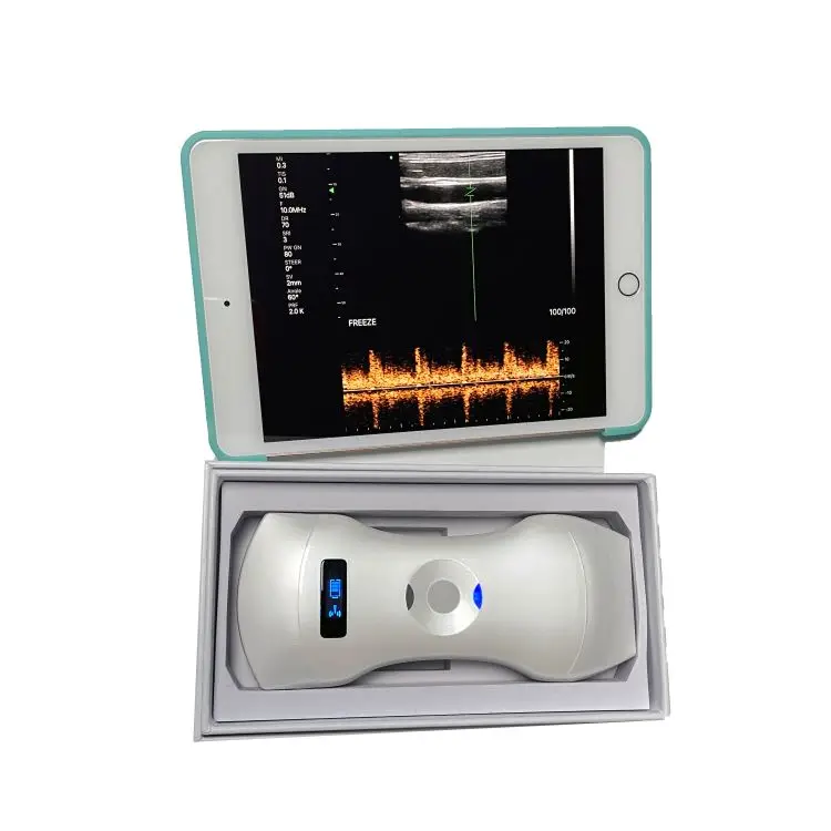 Wireless Double Convex Tranvaigimal Portable 3 in 1 Color Doppler  Ultrasound Probe Machine