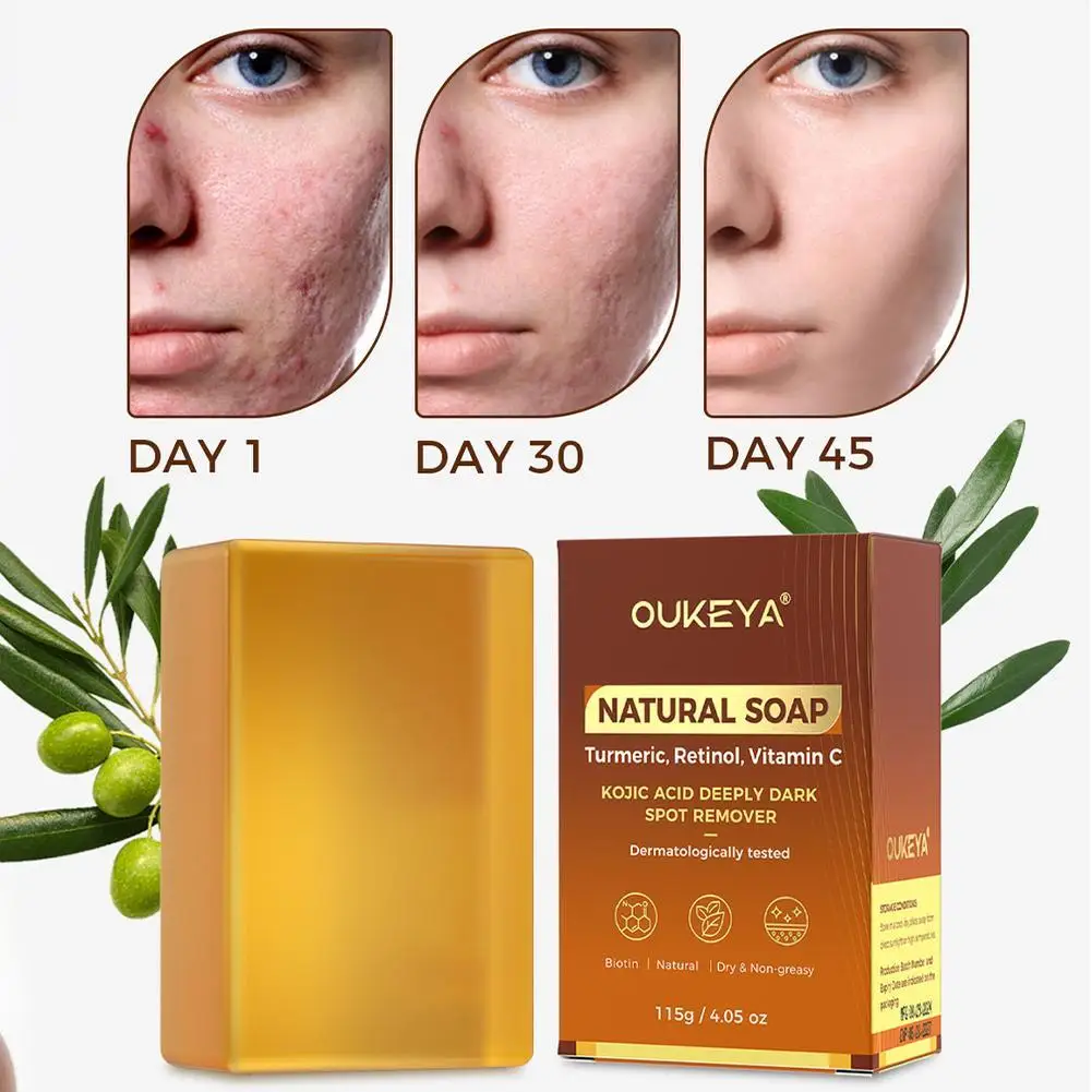 

115g Natural Turmeric Soap Bar with Kojic Acid & Lemon Peel Granules - Exfoliating Face and Body Scrub for Glowing Skin Care