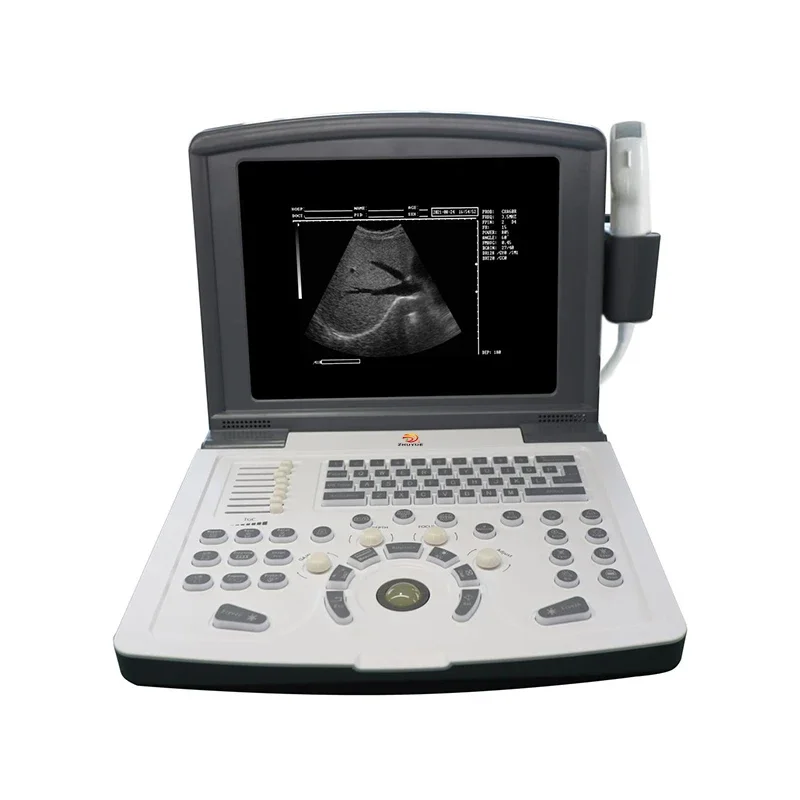 Portable Tcd Medical Transcranial Doppler Ultrasound Machine