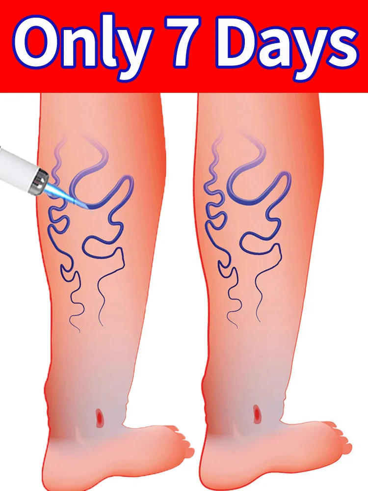 

Get healthy legs in 7 days