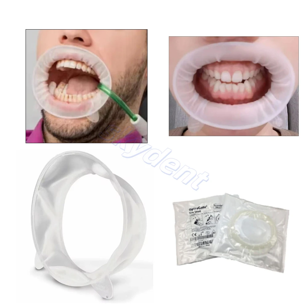 1Pc Dental Mouth Opener 3D Prop Lip Cheek Retractor O Shape Rubber Dam Expander Regular Small For Adult Child Ivoclar Optragate