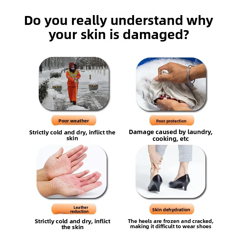 Creme reparador de pele rachada – Fórmula de força clínica para mãos e pés com vários secos, tratamento de fissura no calcanhar com umidade de 72 horas