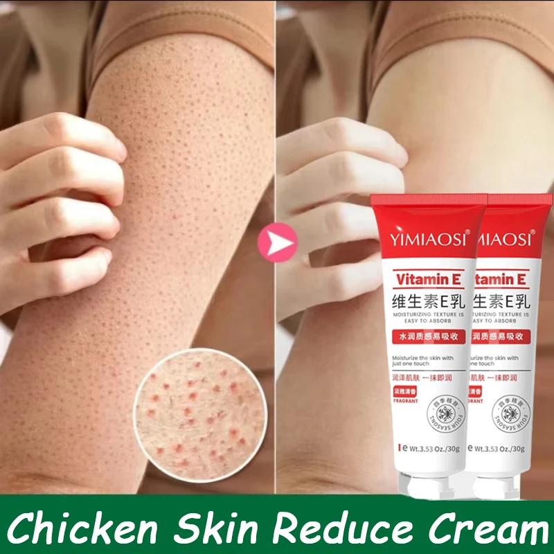 Crème Instantanée Anti-Graine de Riz, Réparatrice Acné, Resserre les Pores, Estompe la Mélanine Corporelle, Éclaircissante, Lisse et Hydrate pour une Peau Saine et Belle 1