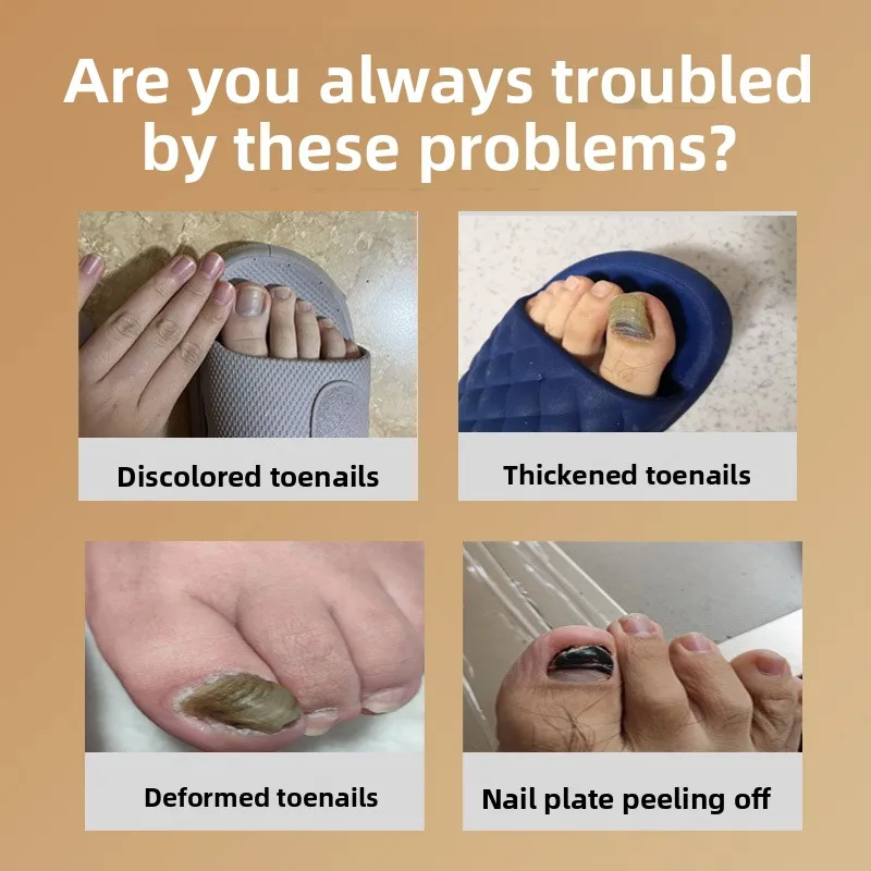 Solução para Unhas Morinokawa Megumi Grey de 30ml - Amaciamento e Remoção de Unhas, Óleo Essencial para Cuidado das Unhas