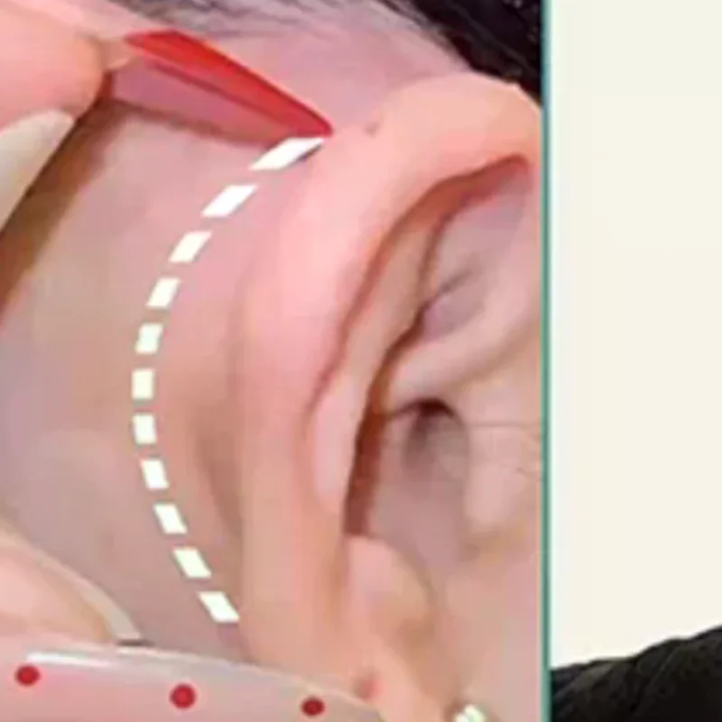 สติกเกอร์ซิลิโคนรูปหูเอลฟ์ 4D รุ่นอัพเกรด แผ่นแปะแก้ไขรูปทรงหูแบบติดเอง ใช้ซ้ำได้ สติกเกอร์หน้าวี ใช้งานง่าย แผ่นแปะเสริมรูปทรงหู