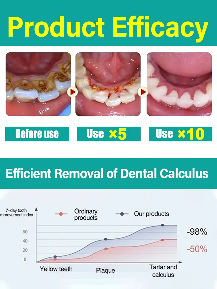 Removedor de cálculo dental, clareamento dos dentes, remoção de odor da boca, mau hálito, prevenção da periodontite