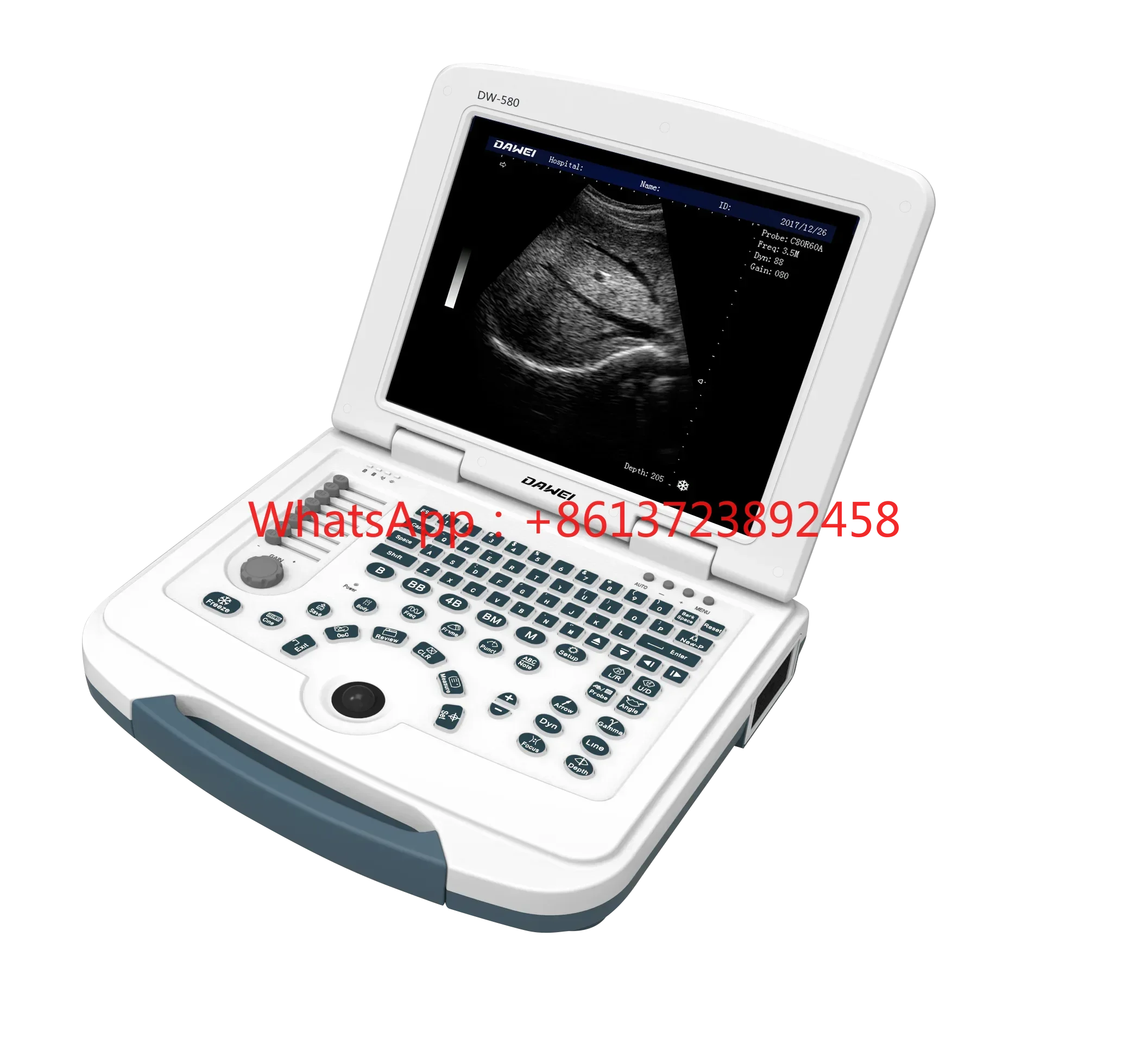 DW-580 Cheapest B/W Portable Ultrasound Machine Full Digital USG Device