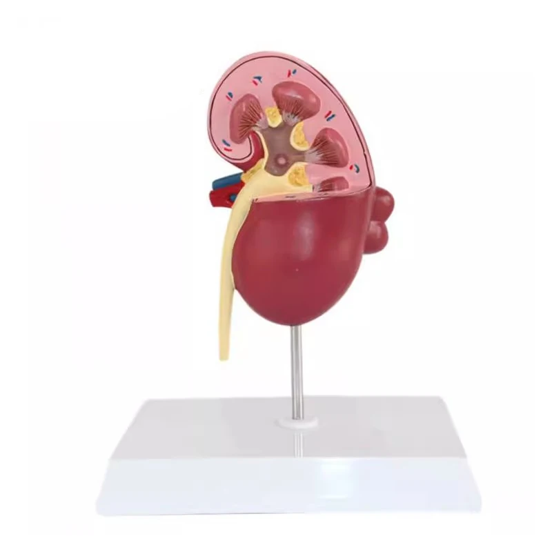 Medical teaching of renal structure of urinary system with natural large kidney model in human urology