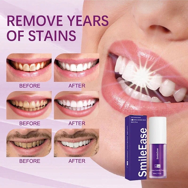 SmileEase-Corrector de Creme Dental Cor Roxa para Dentes, Clareamento Branco, Reduzir Amarelecimento, Cuidado Dental, V34, 30ml, Novo, 2024