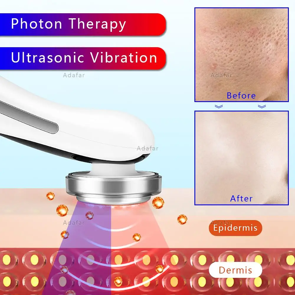 Gesicht Heben Anti Aging Falten Gerät EMS RF Mikrostrom Haut Verjüngung Gesichts Massager Photon Therapie Schönheit Auge Pflege Werkzeug