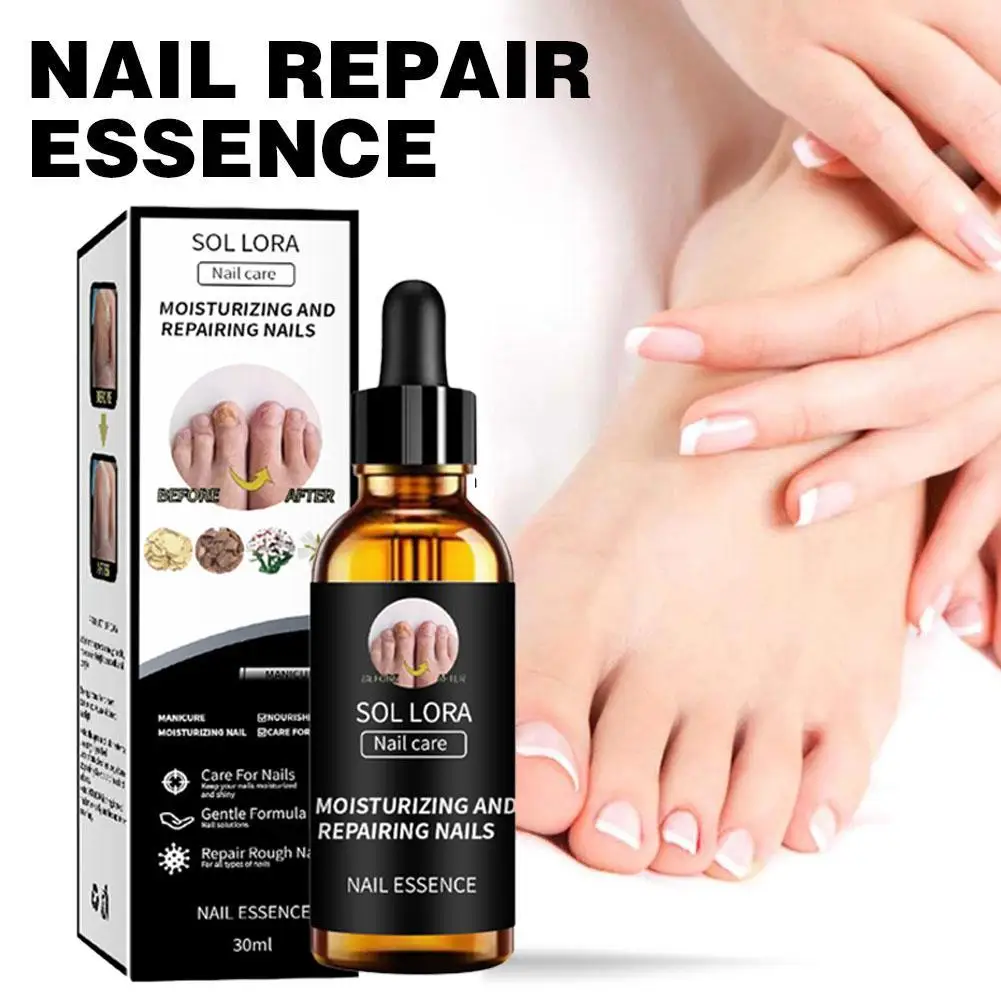 30ml Nail Fungus Treatment Serum Essence Oil Care Repair Feet Anti Nails Removal Toe Essence Cream Infection Gel P4y9