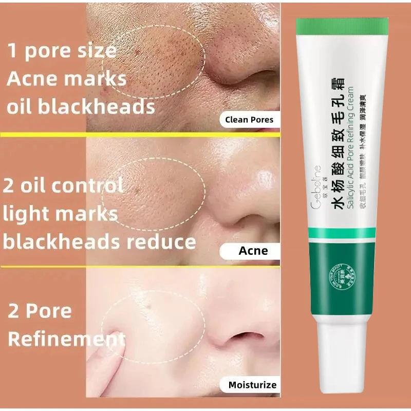 Salicylic Acid Fine Pore Cream Blackhead Removal Oil Control Facial Care Serum Fading Acne Mark Gel Acne Facial Care Products