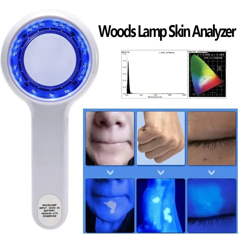 

НОВИНКА: Портативный анализатор кожи Woods Lamp для салонов красоты, УФ-лампа для дерматологического анализа и диагностики