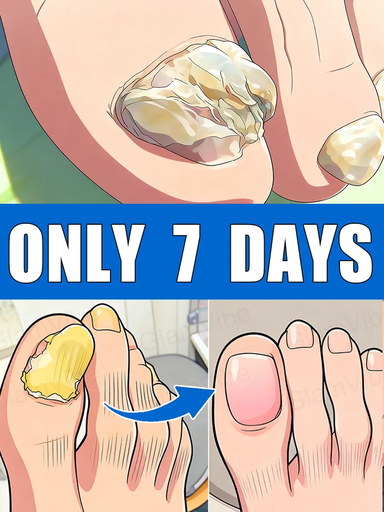 

2025 Restore the natural shine of nails