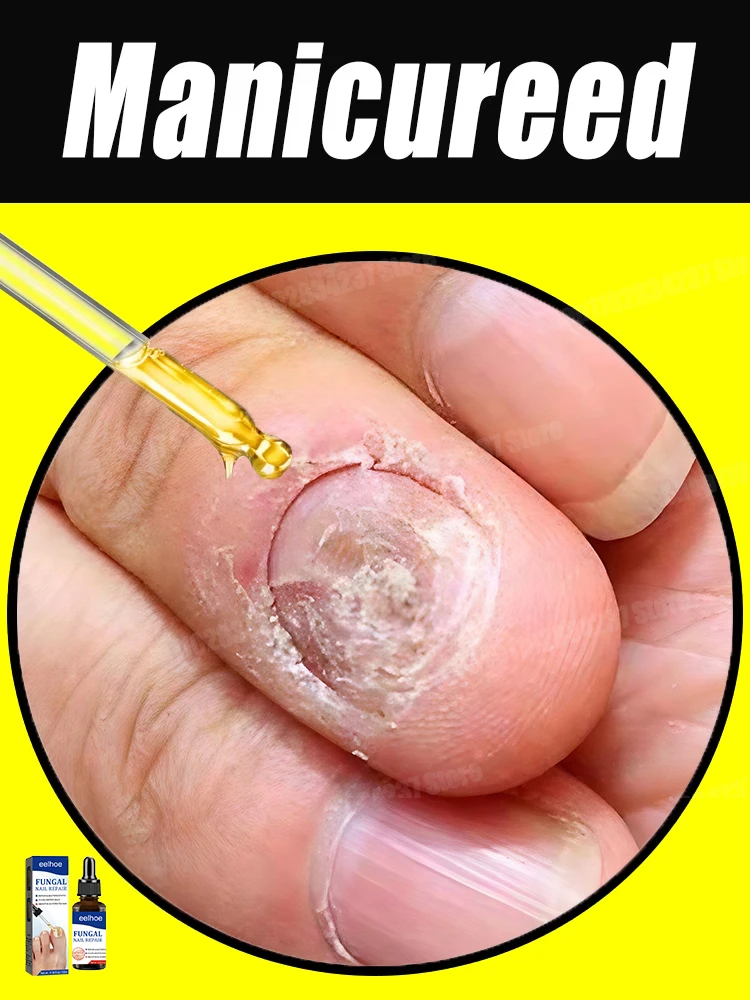 

new hot cleaning nail brush tools, plastic vacuum cleaners, Say goodbye to nail troubles