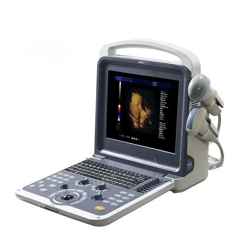 4D Full Digital Color Doppler Ultrasound Diagnostic System Competitive Price 6 Languages Portable Ultrasound