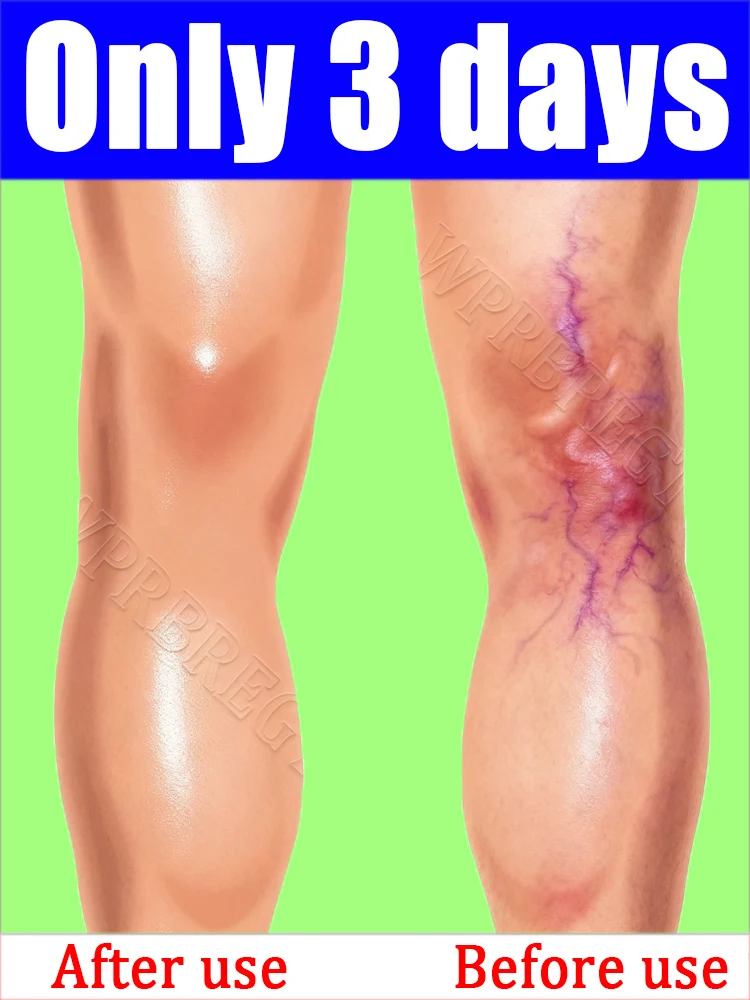 

Vaziсоциальные azi, that can blood iseurazi