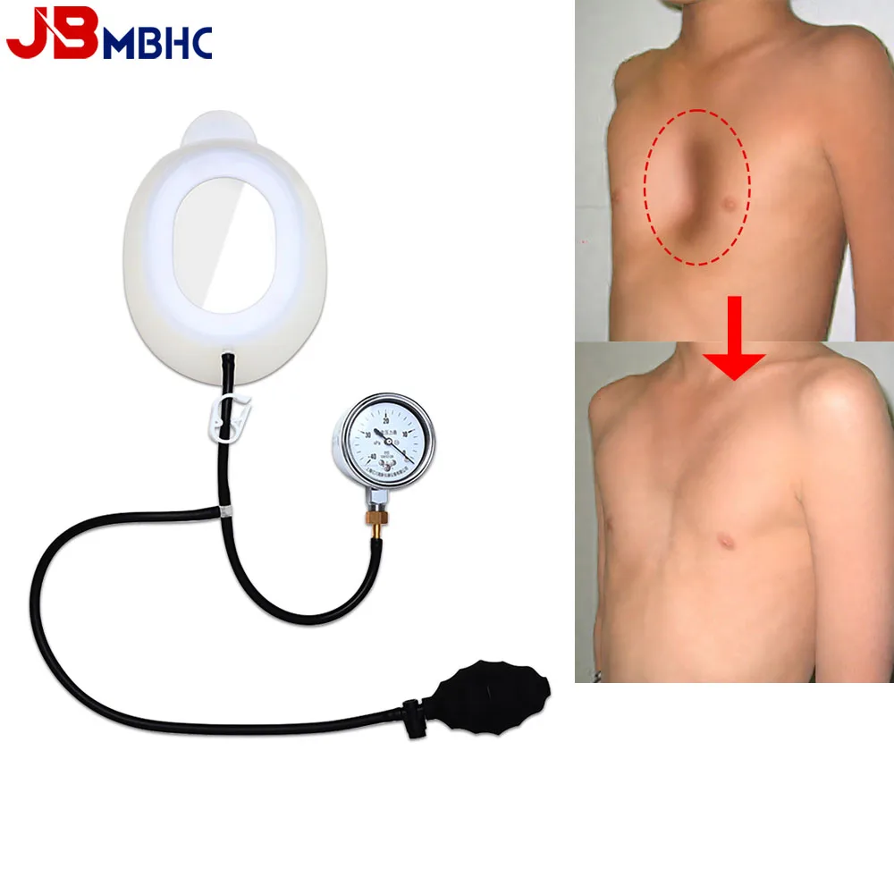 Pectus Excavatum Orthosis Brace Pectus Excavatum Vacuum Bell Sternal Depression Support Sunken Chest Physical Chest Correction