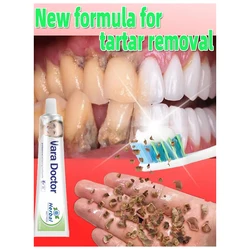 Removedor De Creme Dental De Pedra Dentária, Clareamento, Remove O Mau Hálito, Cuidados De Limpeza Dental