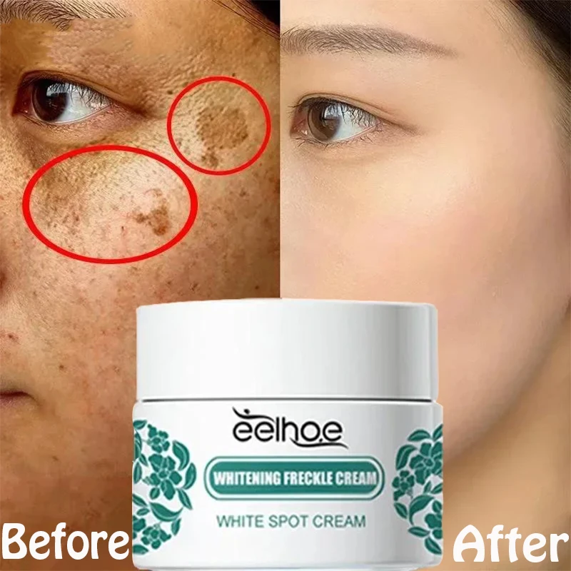 

Niacinamide Melasma Brightening Cream Reduce Melanin Lighten Dark Skin Chloasma Serum Fade Fine Lines Face Care Products ﻿