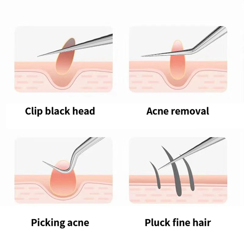 Acne Naald Pincet Licht Mee-eter Smet Puistjes Verwijderen Puntige Bocht Hoofd Gezichtsverzorging Gereedschap Acne Extractor