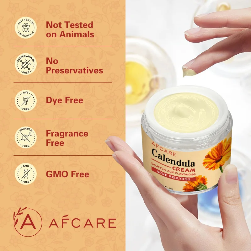 Calendula Herbal Extract Cream For Normal To Oily Skin Reduces Redness Oil Control Skin Care Naturally Heal Skin Irritations