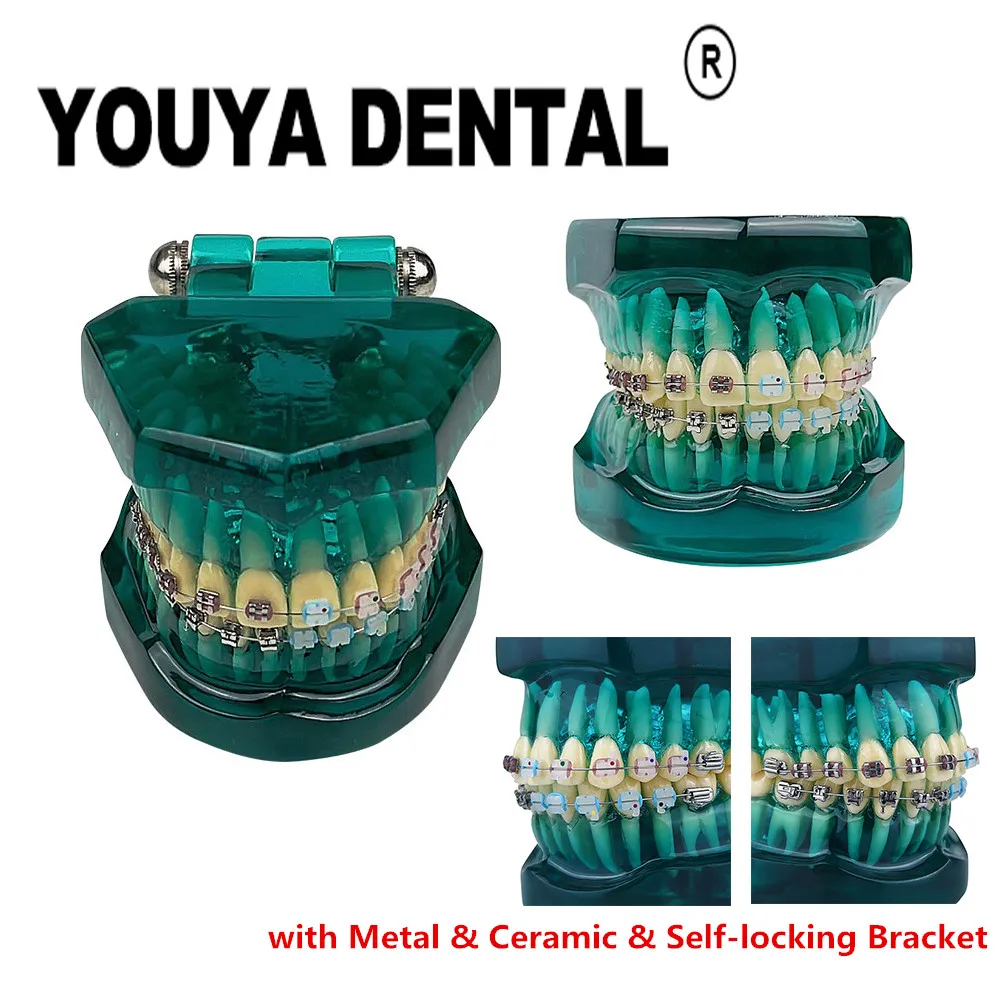 

Metal & Ceramic & Self-locking Orthodontic Model for Dental Technician Student Orthodontic Treatment Teaching Practice Training