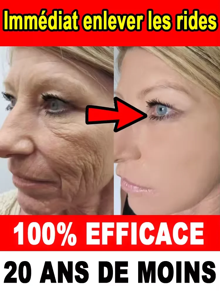 تغيير الجلد، قل وداعا للتجاعيد #2