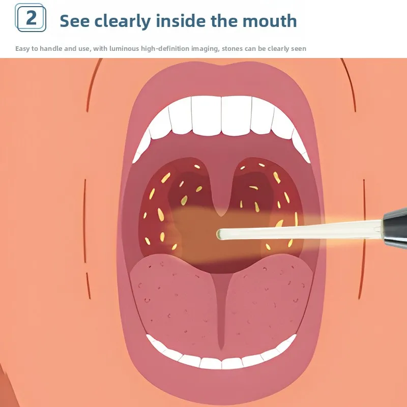 Thumbnail 4 - #48 Latest Ear Care Offers