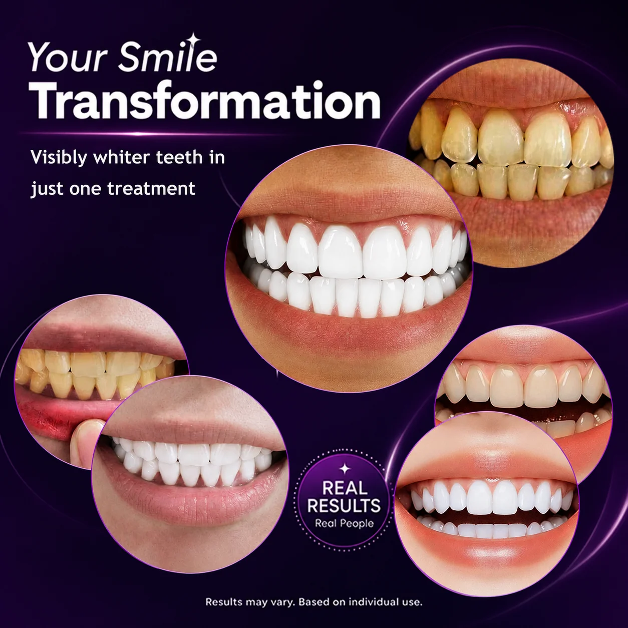 2/4 pary pasków do wybielania  – Teeth Whitening Strips Crest recenzja i cena