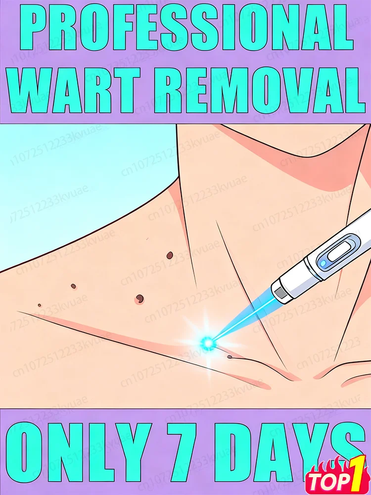 

Интеллектуальное использование: Подходит для физических часов с бородавками.