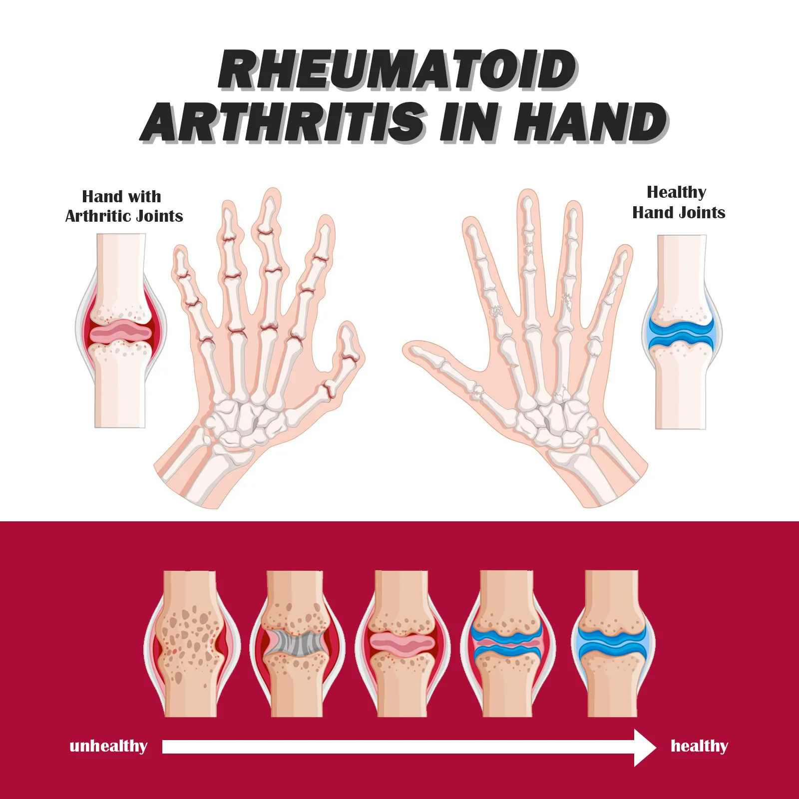 المفاصل العظام الإغاثة الكولاجين كريم العناية تخفيف قطني الركبة آلام العضلات إصلاح يخفف التعب العضلات تدليك كريم علاج 30 جرام