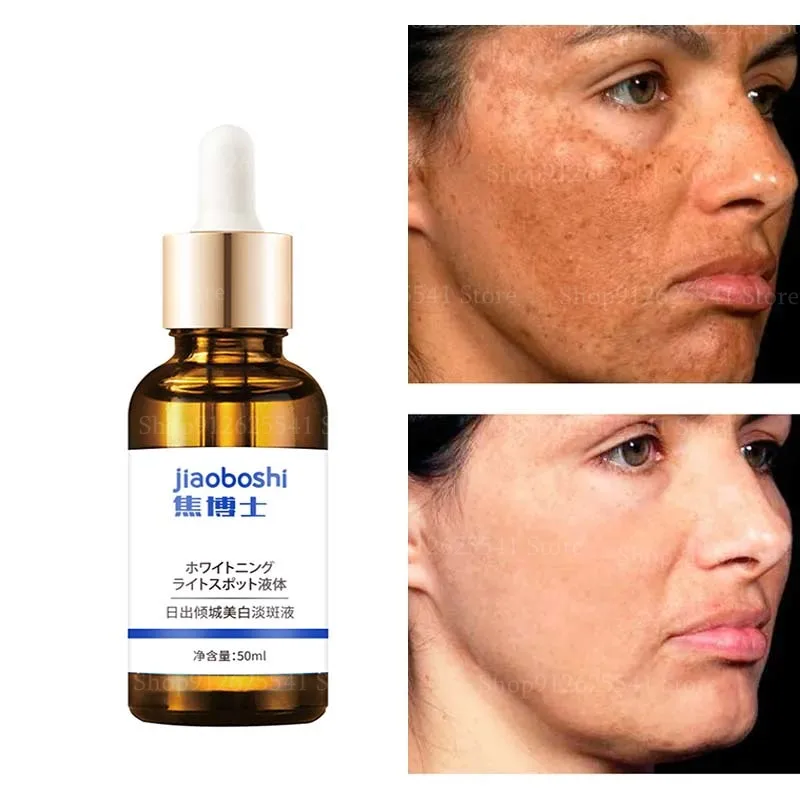 

50ml Fade Pigmentation Melasma Brighten Skin Facial Essence Niacinamide Whitening Essence Staying Up Late Essence Skin Care