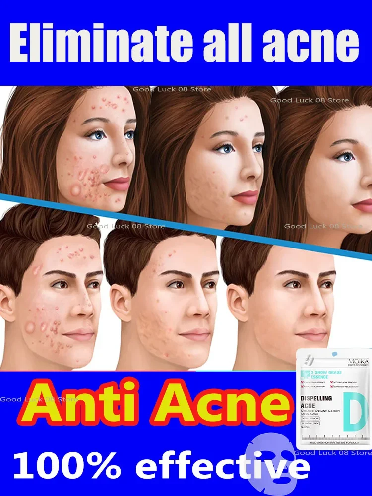 

Anti-acne, moisturizing and refreshing mask, hyaluronic acid mask skin care products