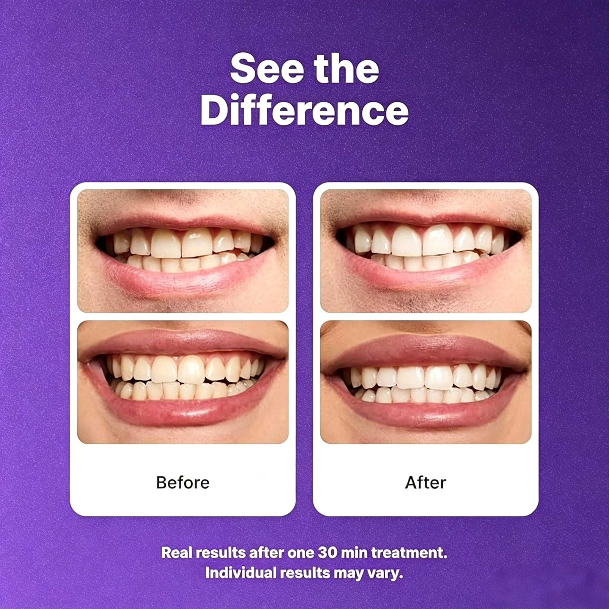 7 Pairs Purple Teeth Whitening Strips, Enamel-Safe Non-Sensitive Non-Slip Whitener Strips,14 Strips for Bright White Grin