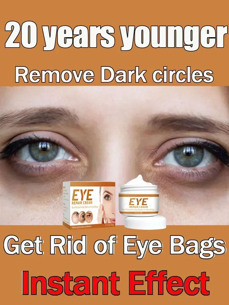 Crema para los ojos con ojeras, elimina las bolsas de ojos, hinchazón, antiarrugas, ilumina los ojos, hidrata, blanquea, cuidado de la piel