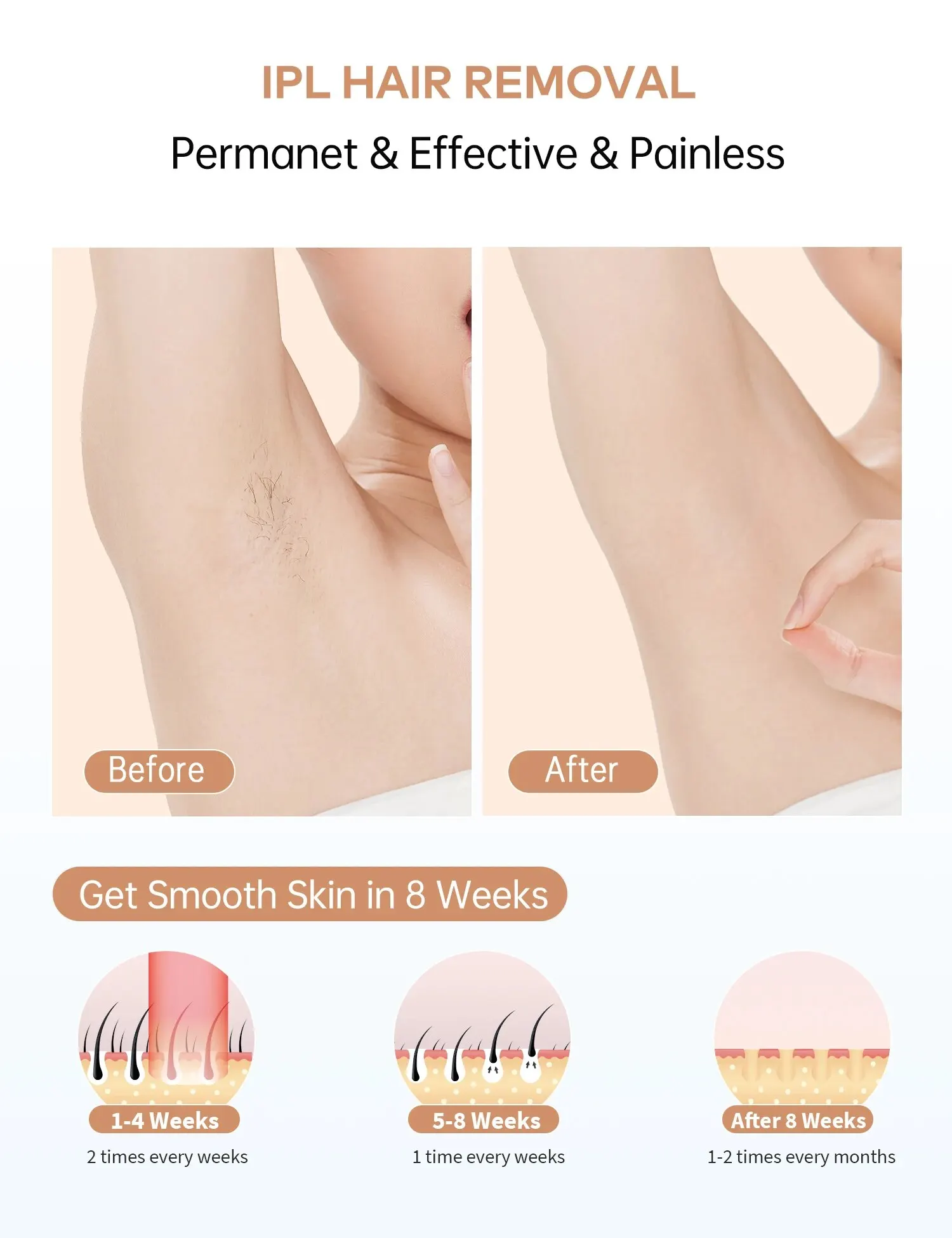 IPL Devices Hair Removal Laser 999900 Light Pulses HR/ SC /RA 9 Levels Whole Body Painless Hair Removal Home Use For Men Women image 3