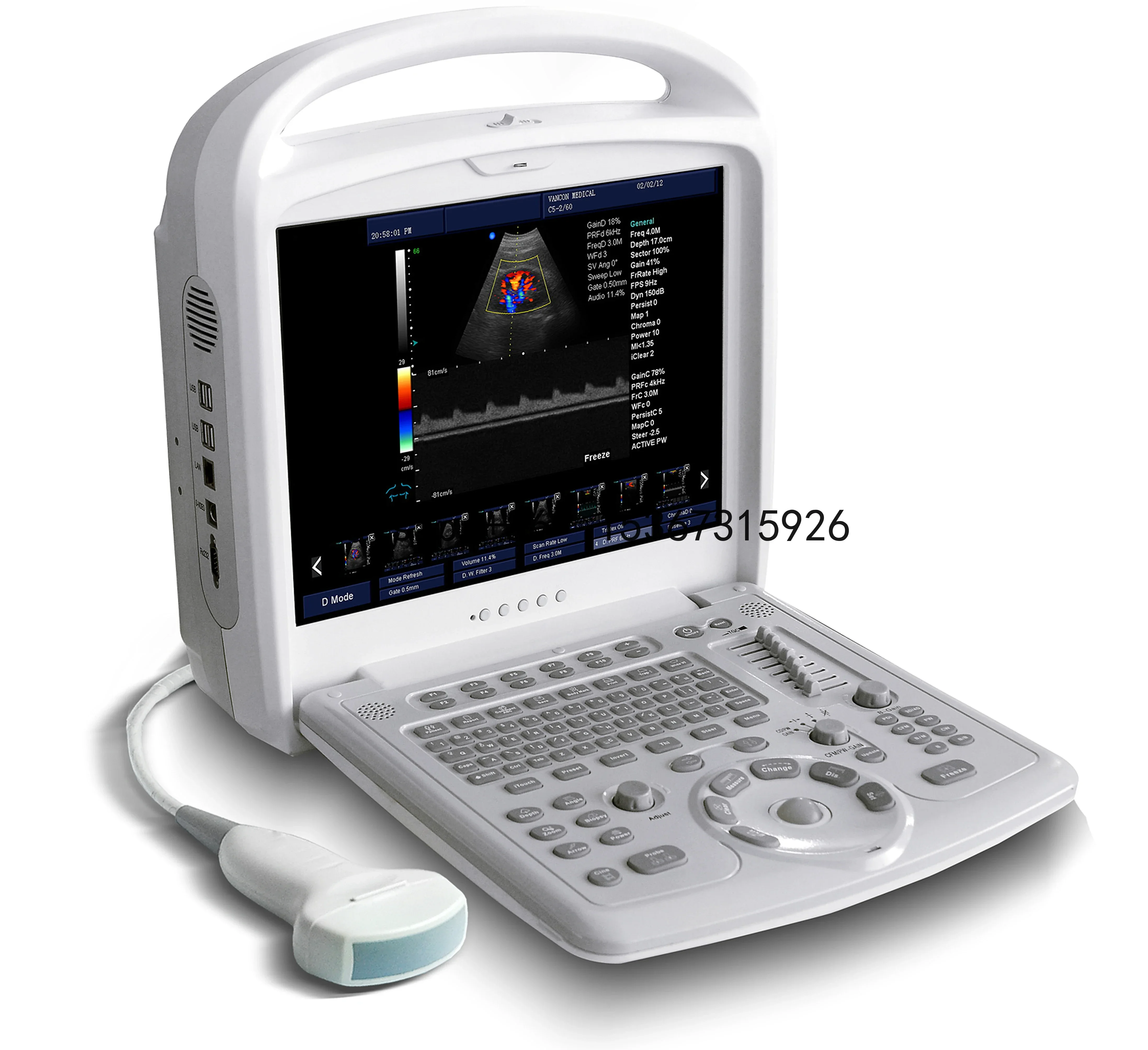 Color Doppler Portable 96 elemeLGMs array 15 inch LED color display Ultrasound Machine