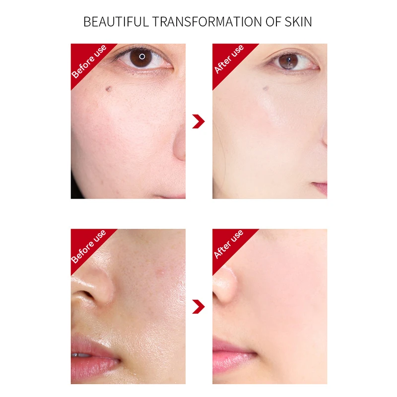 

High end wrinkle essence Fast Absorption Reduces Fine Lines Deeply Hydrates Moisturizes Skin Moisturizes And Shrinks Pores