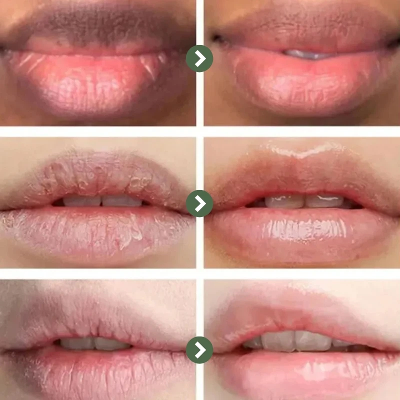 Remove Dark Lip Balm Fast Lightening Dark Smoke Lip Exfoliating Fade Lip Line Dead Skin Deep Moisturize Lipstick Beauty Lip Care