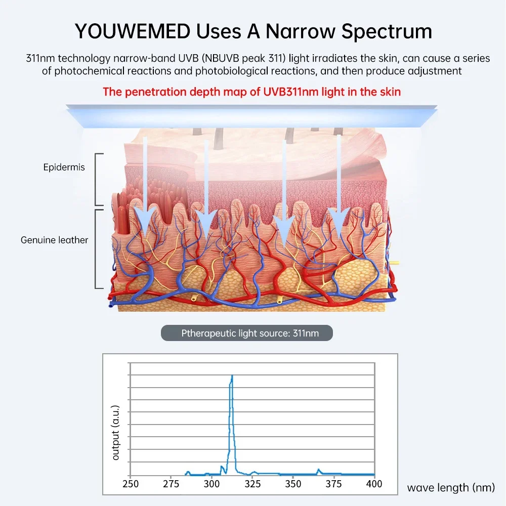 고품질 휴대용 UVB 램프 311nm UV 광선치료 필수 물리치료 장비 효과적인 치료용